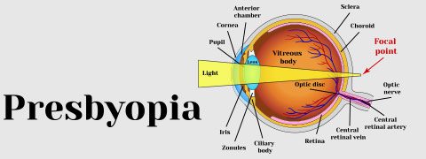 PresByopia-the-ulimate-guide